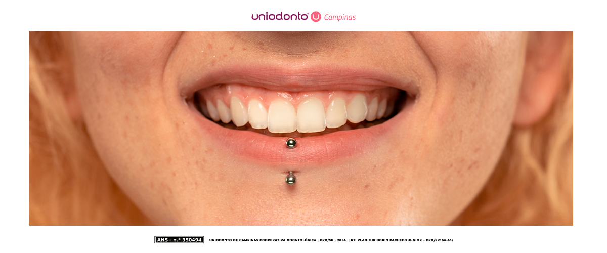 Ter piercing na boca exige cuidados especiais. Descubra como prevenir infecções, retração gengival, fraturas dentárias e perda de papilas gustativas com práticas simples de higiene bucal.